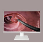 white medical monitor